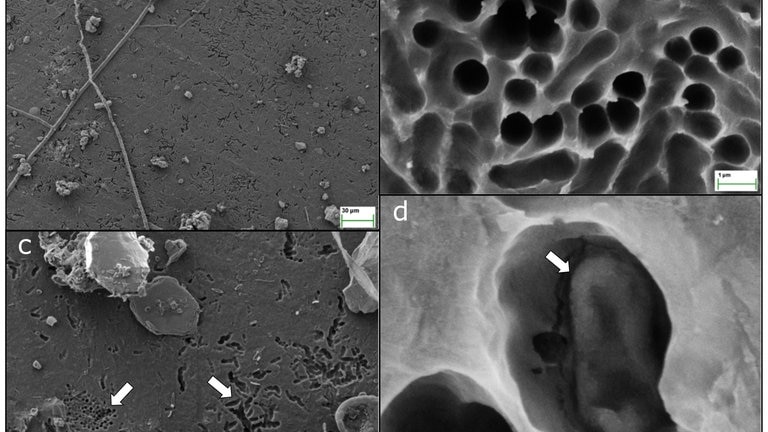 Auf den elektronenmikroskopischen Aufnahmen sind mikrometergroße Löcher in einer Bio-Plastikfolie zu sehen. Hineingefressen durch die Bakterien mit dem "Pac-Man-Enzym". 