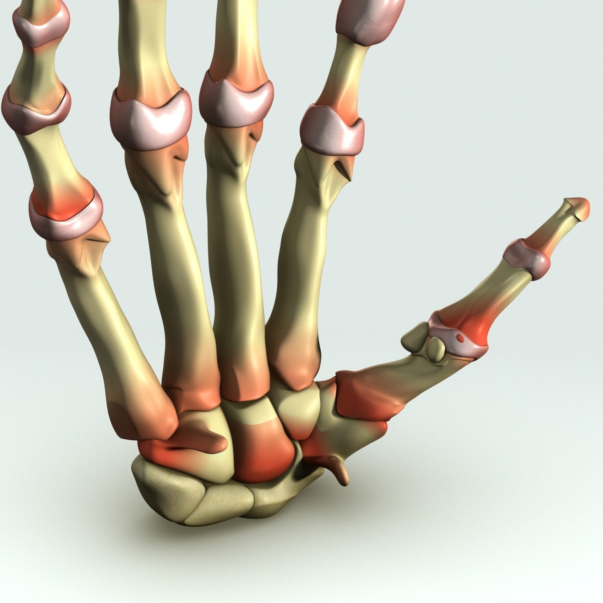 Arthrose und Arthritis/Rheuma – Was ist der Unterschied? episode artwork