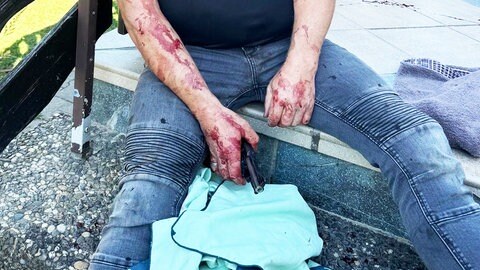 Das verletzte Opfer sitzt auf einer Treppe und hält die Tatwaffe in der Hand. Sein Nachbar hatte mit dem Revolver auf ihn gezielt und abgedrückt, die Schüsse hatten sich nicht gelöst. Das Opfer konnte den Täter überwältigen und ihm den Revolver abnehmen.