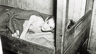 Ein an Typhus erkrankter Überlebender des KZ Bergen-Belsen nach der Befreiung des Konzentrationslagers am 15. April 1945 durch britische Truppen
