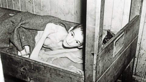 Ein an Typhus erkrankter Überlebender des KZ Bergen-Belsen nach der Befreiung des Konzentrationslagers am 15. April 1945 durch britische Truppen