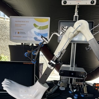 Ohne Operateur geht nichts. Ab September wird die Robotik in der Orthopädie im Städtischen Krankenhaus Pirmasens am Standort Rodalben genutzt. 