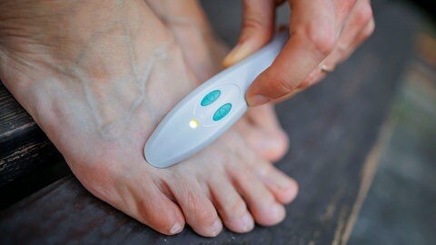 Eine Frau behandelt einen Mückenstich an ihrem Fuss mit einem elektrischen Stichheiler.