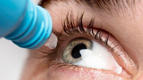 Eine Person tropft sich Augentropfen in ihr Auge. Während Tropfen beim Grünen Star zwar helfen, könnte die Elektrostimulation den weiteren Zerfall der Zellen womöglich stoppen.