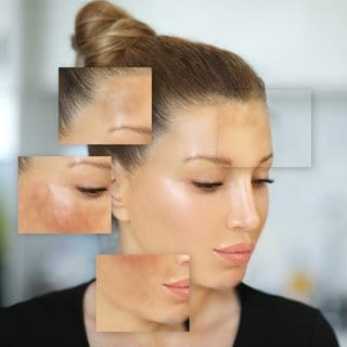 Frau mit Pigmentflecken