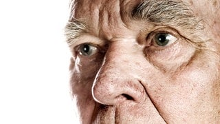 Senior mit einer großen Nase: Wie jedes Körperteil wächst auch die Nase meistens bis zum Ende der Pubertät. Doch bei der Nase ist dann noch nicht Schluss: Sie wird im Alter größer. Die Ursache liegt im Knorpel- und Bindegewebe.