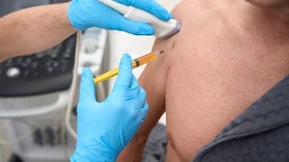Ausschnittaufnahme eines Arztes in OP-Handschuhen, der einen Ultraschallkopf auf die Schulter einer Person drückt und eine Spritze einführt.