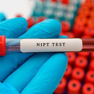 NIPT