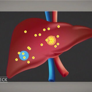 Cholesterin