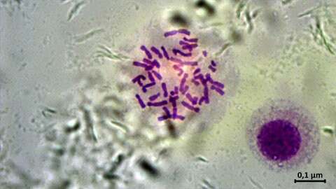 Menschlicher Chromosomensatz unter dem Mikroskop. Jedes Chromosom ist eine lange DNA-Kette. Die DNA enthält genetische Informationen. 