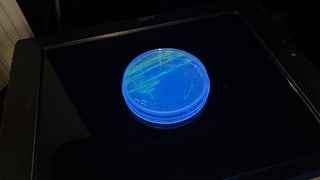 Für immunschwache Menschen und bei offenen Wunden kann der Krankenhauskeim Pseudomonas gefährlich werden. 