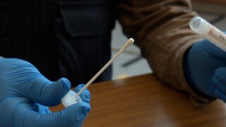 DNA-Teststäbchen