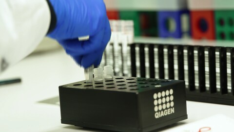 Eine umfassende genetische Analyse zur Diagnose von seltenen Erkrankungen ist zwar technisch möglich, die Umsetzung war aber bisher selbst im Verdachtsfall schwer - aus finanziellen Gründen.