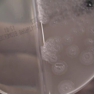 Multiresistente Keime – wie man sich schützt