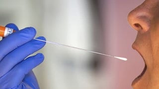 Person führt Speicheltest durch für Bakterien im Magen und Dünndarm.
