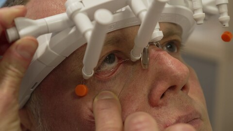 Ein Patient trägt das Gerät zur Elektrostimulation beim grünen Star auf dem Gesicht. Dabei verläuft über dem Auge ein feiner Drat, der die Elektroimpulse durch Kontakt mit dem Auge an die Nervenzellen schickt.