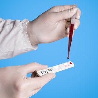 Drogentest, Blutuntersuchung. Symbolfoto.