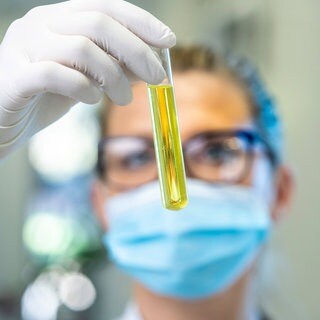 Laborantin analysiert eine Probe: Die Analyse von Abwasserproben verrät, was wir essen, welche Krankheiten wir haben und welche Drogen wir nehmen. EU-weit wird das Monitoring ausgeweitet.