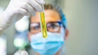 Laborantin analysiert eine Probe: Die Analyse von Abwasserproben verrät, was wir essen, welche Krankheiten wir haben und welche Drogen wir nehmen. EU-weit wird das Monitoring ausgeweitet.