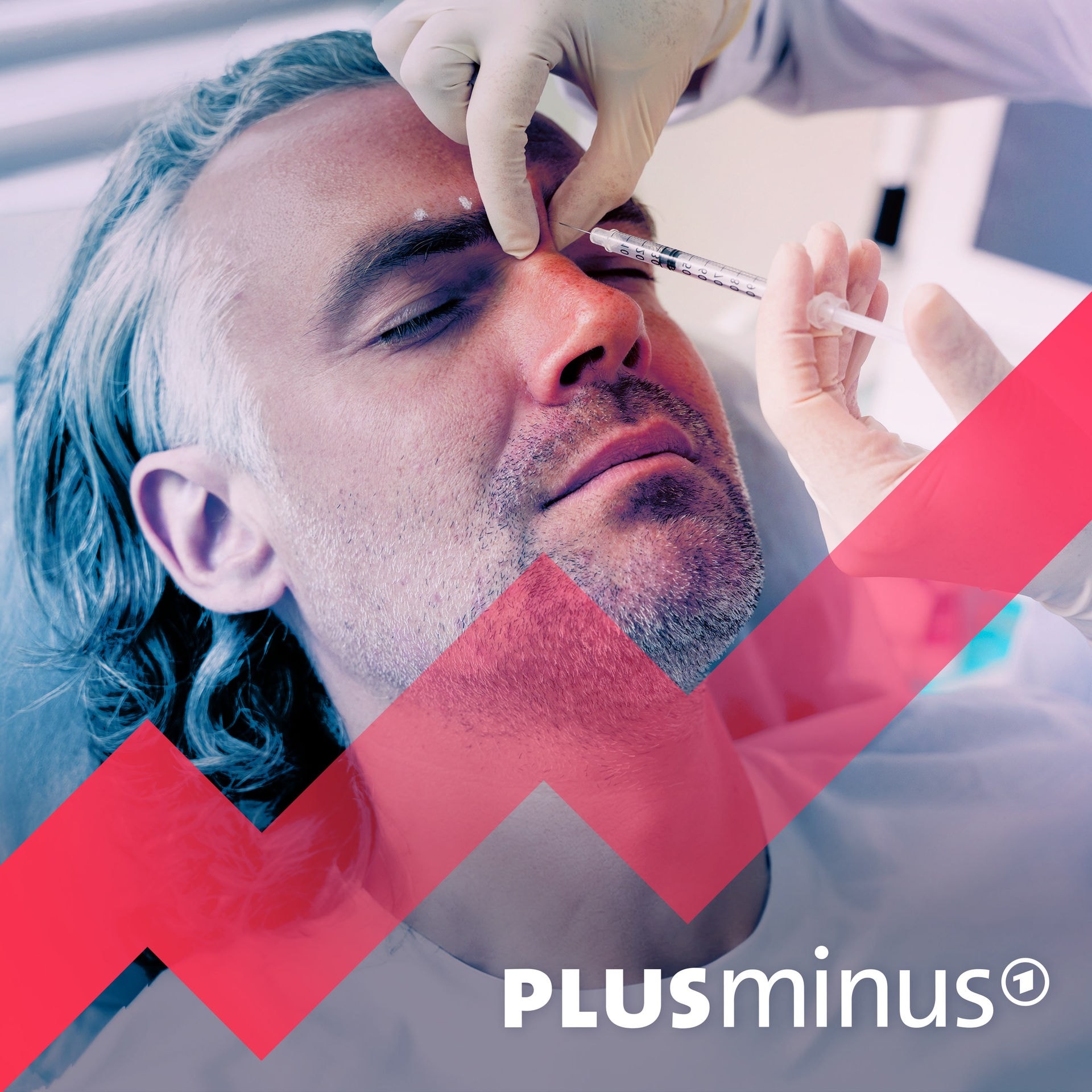 Botox & Co: Müssen Männer schön sein für den Erfolg im Job?
