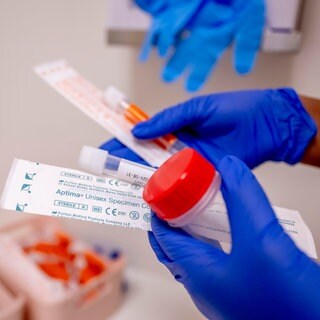 Testkit für Geschlechtskrankheiten: Infektionen durch Sex mit Syphilis- oder Tripper-Bakterien oder Chlamydien werden oft weitergegeben, weil viele sich nicht regelmäßig testen lassen. Die Folge: Schmerzen Unfruchtbarkeit; auch bei Männern