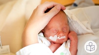 Ein kleines Baby schläft. Das Baby bekommt Luft durch einen dünnen Schlauch in seiner Nase. Eine Hand streichelt den Kopf von dem Baby. Rechts das SWR Logo für Leichte Sprache.