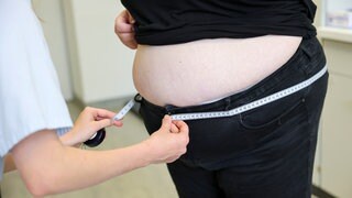 Der Hüftumfang einer krankhaft übergewichtigen Frau wird gemessen.