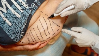 Adipositas-Experte über Übergewicht, Magen-OP und Abnehmspritze