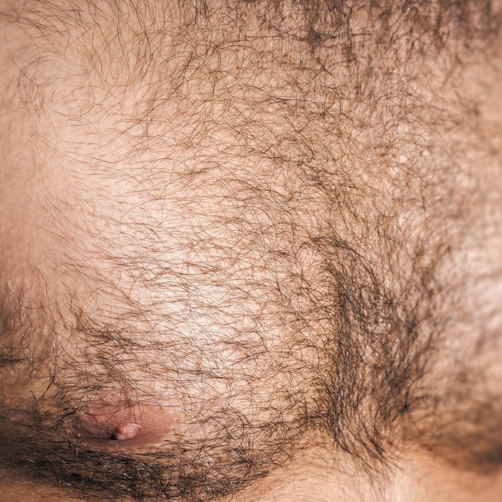 Ist es hygienischer, wenn man den Körper rasiert? episode artwork